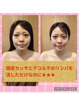 リベラ(LIBERA)/デコルテリンパと頭皮カッサ