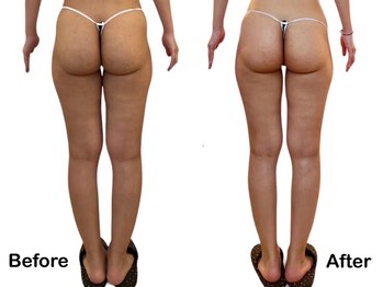 アロマテラピー 古香/話題のボディマシンでスッキリ