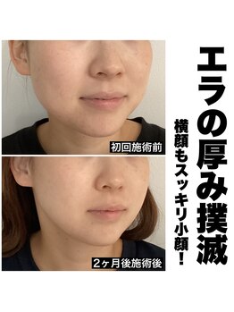 リシェ 市川(riche)/