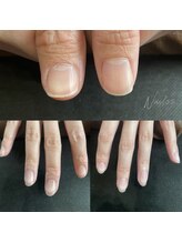 ネイルゴーゴー(NAIL55)/ネイルケアbefore 2