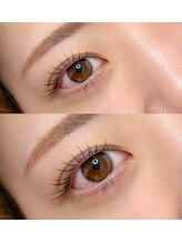 プティカラン(Petite Calin)/ダメージレスラッシュリフト