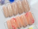 定額夏ネイルデザインぷっくり花