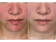 ハティア(hattia)の雰囲気（丁寧なカウンセリングが◎豊富な知識で健康美への近道を伝授♪）