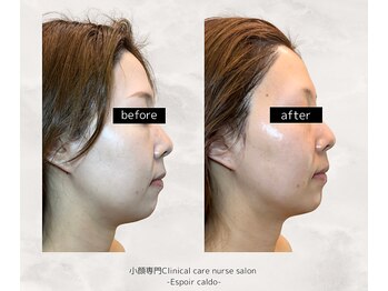 エスポワールカルド(Espoir caldo)/