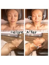 マラエ 本八幡店(Malae)/ラフォスフェイシャル