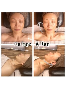 マラエ 本八幡店(Malae)/ラフォスフェイシャル