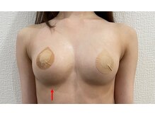 ハーグレイス 表参道外苑前(Her Grace)の雰囲気（1回の施術でもバストアップを実感いただくお客様続出♪）