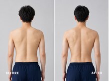 ミネルバ(MINERVA)/【施術例】　30代男性　痩身