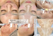 クレヴィー(Creviy)