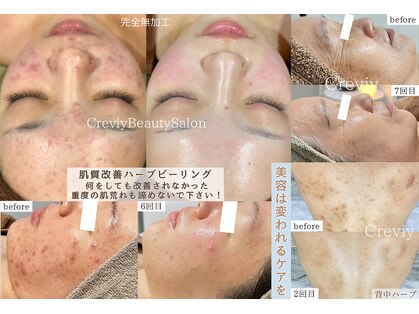 クレヴィー(Creviy)の写真