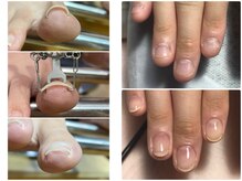 シャットネイル(CHATTE NAIL)