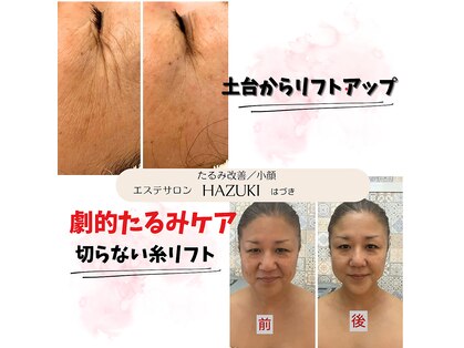 ハズキ(HAZUKI)の写真