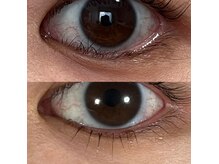 下の逆まつげの方にもおすすめなまつげパーマ