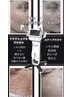 【プラズマフェイシャル】全顔エアートライアル　通常¥20900→¥13200