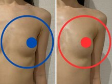 ポインセチア(Poinsettia)/ボリュームアップ&リフトアップ