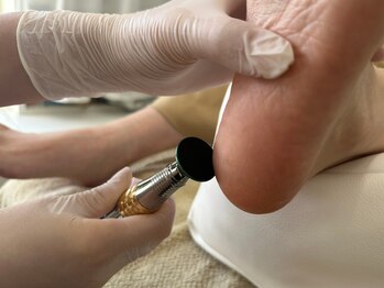 ルポ(REPOS)/角質ケア【２】