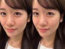 ソリン(Solin')/まつげパーマと眉ワックス