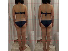 フロー(Flow)/ビフォアフター【根本改善筋膜】