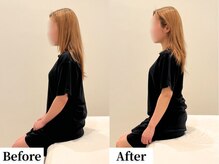 ソレア(Solea)/巻き肩改善１回目