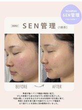 リベレ(Libelle)/敏感肌・ニキビ肌さん