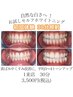 【初回体験 30分照射】 自然な白さへお試しセルフホワイトニング 