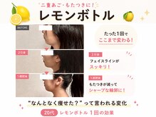 リル(Rire)/ララピール/レモンボトルの変化
