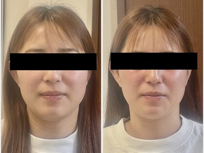 セルビューティー(Cell Beauty)の写真