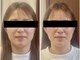 セルビューティー(Cell Beauty)の写真