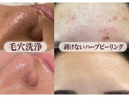 メグリス(Meglys)の写真