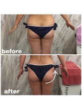 ラニ(LANI)/新型ハイパーナイフ6