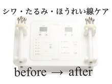 ブランシェ 富山店 × 椿/奇跡の表情筋ケア☆効果を即実感