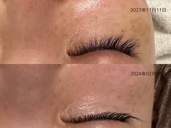 レイル(REIR)/メニュー:純粋レチノールピール