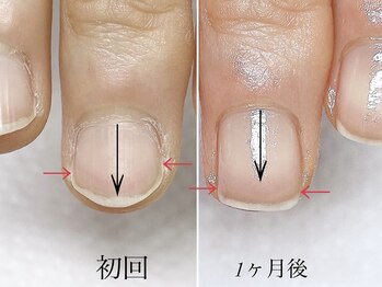 トゥインクリーネイルサロン(Twinkly Nail Salon)/【最強のネイルケア】1回お試し