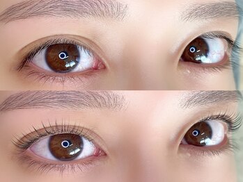 リトマス(LITMUS)/...みて？