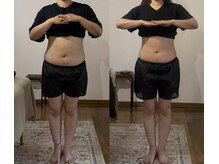 しあわせ腸研究所/before＆after