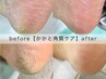 ガサガサ踵に♪【 かかと角質ケア 】ひび割れが気になる方も◎初回爪切り無料