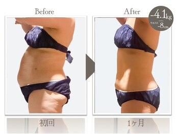 ビューティーリバース 海老名店/★劇的ビフォーアフター★