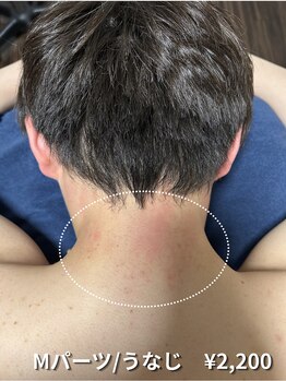 カナウ(KANAU)/【Mパーツ/脱毛】うなじ