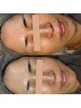 ビエン(美艶 b.en)/肌本来の透明感爆誕！