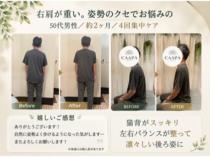 チャーパ(CAAPA)の写真