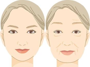 サロン ルイス アディクト(salon Lewis Addict)/【タイトニング】名古屋初導入!