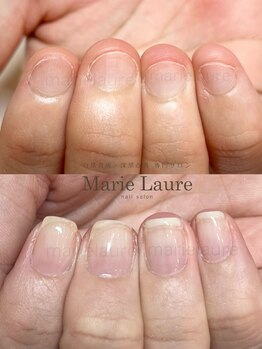 マリーロール 淀屋橋本店(Marie Laure)/自爪育成/深爪矯正/ネイルケア