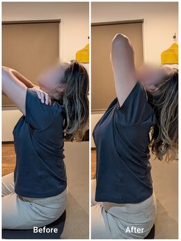 リバース(Re:Birth)/背部がガチガチのお客さま