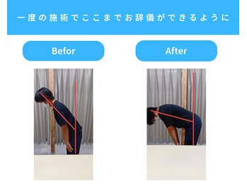 きくち整骨院/お辞儀をした時の痛みが改善