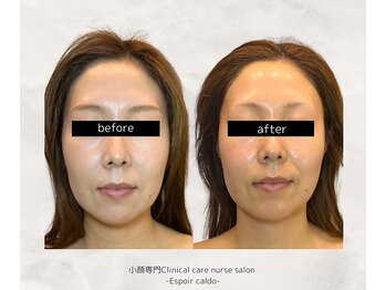 エスポワールカルド(Espoir caldo)/