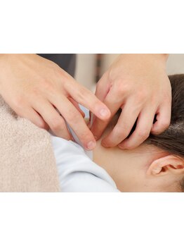 鍼灸施術を受けたい