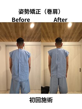 リターズ鍼灸治療所 天王寺院/Before/After