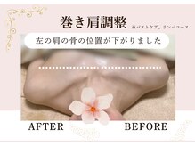 アリサナ(Arisana)の雰囲気（1回でこの変化！姿勢改善。葛西/西葛西/浦安/市川/妙典/バスト）