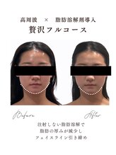 エフリア 大垣(F.lia)/すっきりフェイスライン