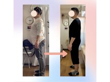 整体院 ツイてる(椎照)/姿勢改善